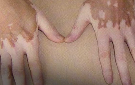 o4YBAFb7f4KAbND1AACDgUROf9A76.jpg