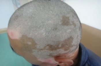t012e7752e798b06f5d.jpg